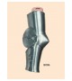 Medieval Arm Armor